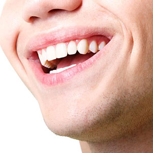 A close up of a person 's smile with teeth.