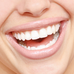 A close up of the teeth of a woman smiling