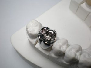 dental crown